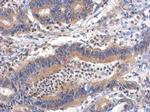 GHDC Polyclonal Antibody