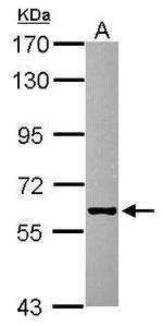 GHDC Antibody in Western Blot (WB)