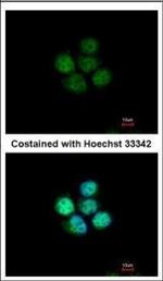ZNF587 Polyclonal Antibody