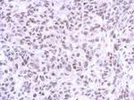 ZNF587 Antibody in Immunohistochemistry (Paraffin) (IHC (P))