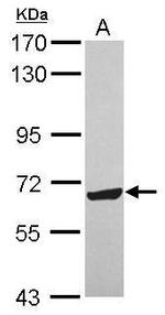 ZNF587 Antibody in Western Blot (WB)