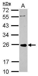 PRKCDBP Polyclonal Antibody