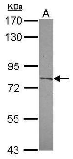 CPXM2 Polyclonal Antibody