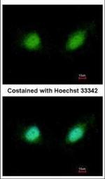 GABPB2 Antibody in Immunocytochemistry (ICC/IF)