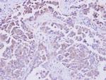 PHOSPHO1 Antibody in Immunohistochemistry (Paraffin) (IHC (P))