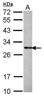 PHOSPHO1 Antibody in Western Blot (WB)
