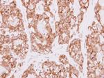 SDR16C5 Polyclonal Antibody