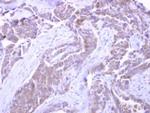 SNX33 Polyclonal Antibody
