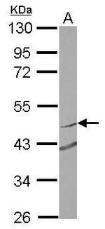 RNF180 Antibody in Western Blot (WB)