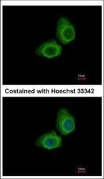 UBE2O Polyclonal Antibody