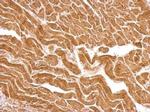 UBE2O Antibody in Immunohistochemistry (Paraffin) (IHC (P))