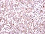 TRIM49 Polyclonal Antibody