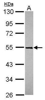 TRIM49 Antibody in Western Blot (WB)