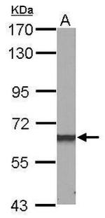 DAB1 Antibody in Western Blot (WB)