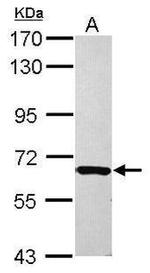 DAB1 Antibody in Western Blot (WB)