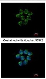 SERPINA4 Polyclonal Antibody