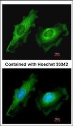 ITM2B Polyclonal Antibody