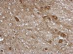 ITM2B Antibody in Immunohistochemistry (Paraffin) (IHC (P))