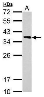 Calponin 2 Polyclonal Antibody