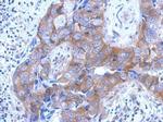 Brevican Polyclonal Antibody