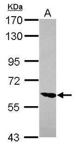 ZNF76 Antibody in Western Blot (WB)