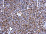 OVCA2 Polyclonal Antibody