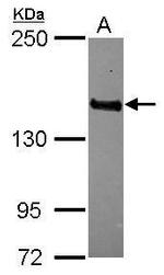MAGI3 Polyclonal Antibody