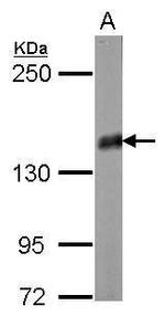 PPFIA2 Antibody in Western Blot (WB)