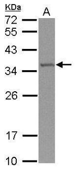 TRMT61A Polyclonal Antibody