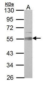 AAMP Antibody in Western Blot (WB)