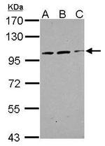 TRAK2 Polyclonal Antibody