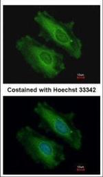 SNX18 Polyclonal Antibody