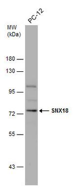 SNX18 Antibody in Western Blot (WB)