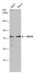 SNX18 Antibody in Western Blot (WB)
