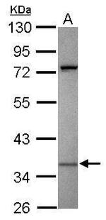 KIR2DS2 Antibody in Western Blot (WB)