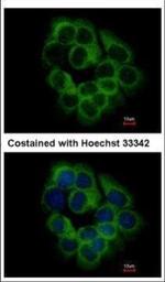 KIR2DS2 Polyclonal Antibody