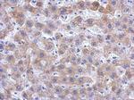 KIR2DS2 Antibody in Immunohistochemistry (Paraffin) (IHC (P))