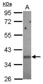 KIR2DS2 Antibody in Western Blot (WB)