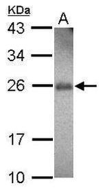 RhoF Antibody in Western Blot (WB)