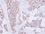 SARS2 Antibody in Immunohistochemistry (Paraffin) (IHC (P))