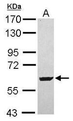 SARS2 Antibody in Western Blot (WB)