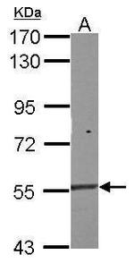 NAC1 Polyclonal Antibody