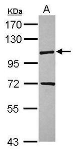 KIF18A Polyclonal Antibody