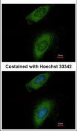 Annexin A8 Polyclonal Antibody