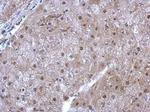 HSPA6 Antibody in Immunohistochemistry (Paraffin) (IHC (P))