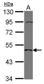 TMPRSS11B Antibody in Western Blot (WB)