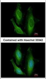 STBD1 Polyclonal Antibody