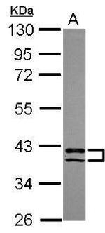PDLIM2 Polyclonal Antibody