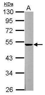 Spinesin Antibody in Western Blot (WB)
