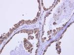 DDX43 Antibody in Immunohistochemistry (Paraffin) (IHC (P))